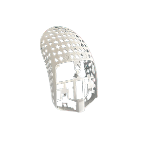 Aluminum